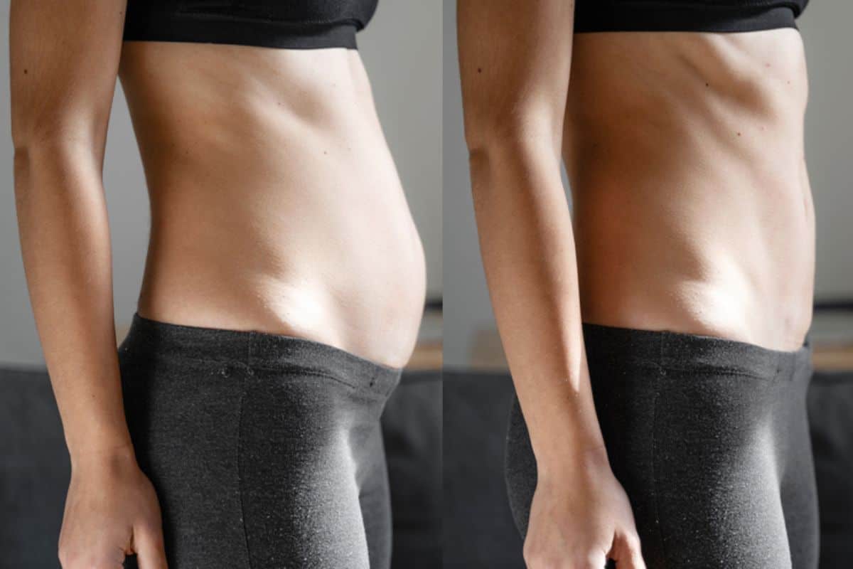 Post-Pregnancy: What Happens to Your Abdominal Muscles After Birth Billericay