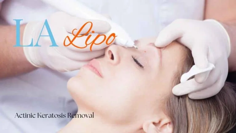 Woman receiving Actinic Keratosis Removal Treatment Billericay