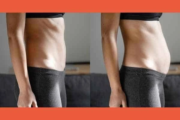 LA-EMS Body Sculpting results Billericay