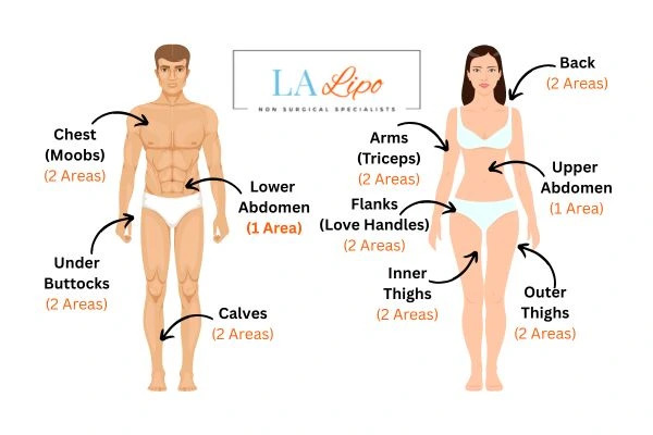 LA LIPO Cryolipolysis Areas Billericay