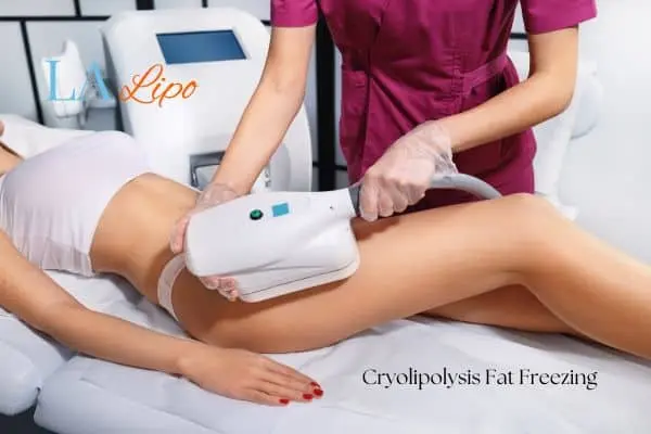 Woman receiving coolsculpting Billericay treatment on her thighs