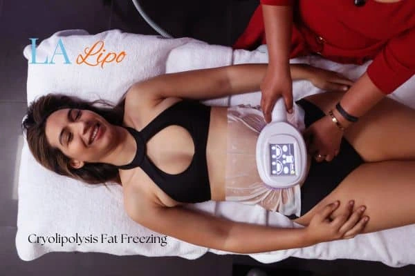 woman getting cryolipolysis Billericay