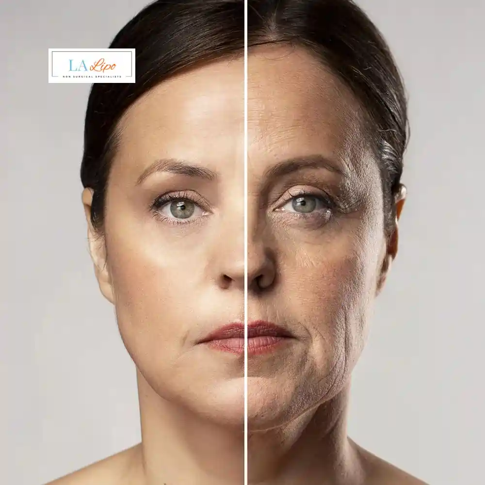 How Can You Tell If Non-Surgical Skin Tightening Is Right for You Billericay?