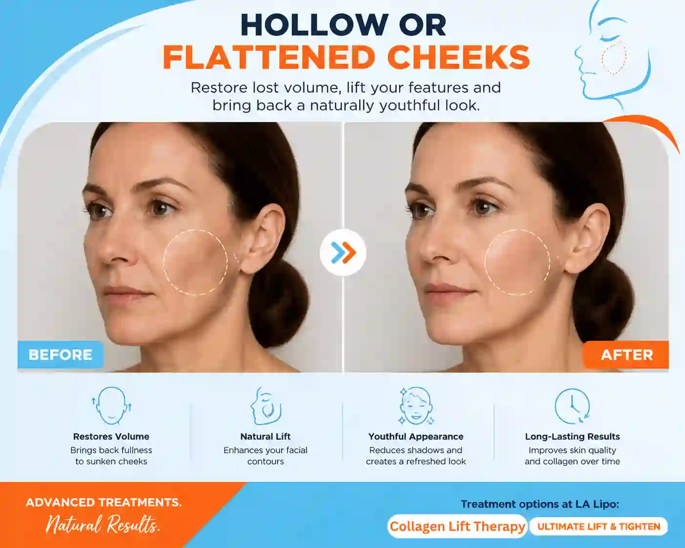Sign #4: Hollow or Flattened Cheeks Billericay