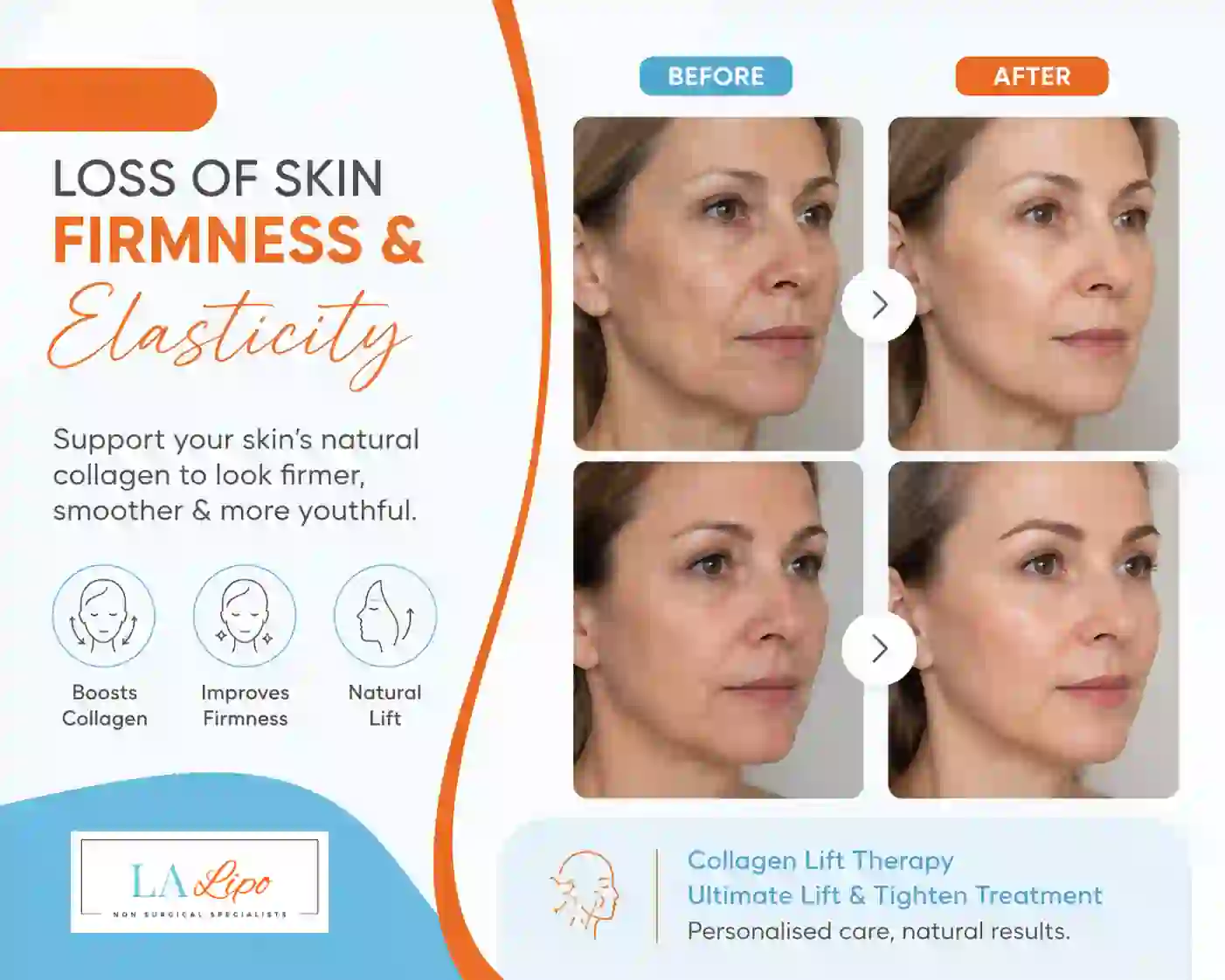 Sign #7: Loss of Skin Firmness and Elasticity Billericay