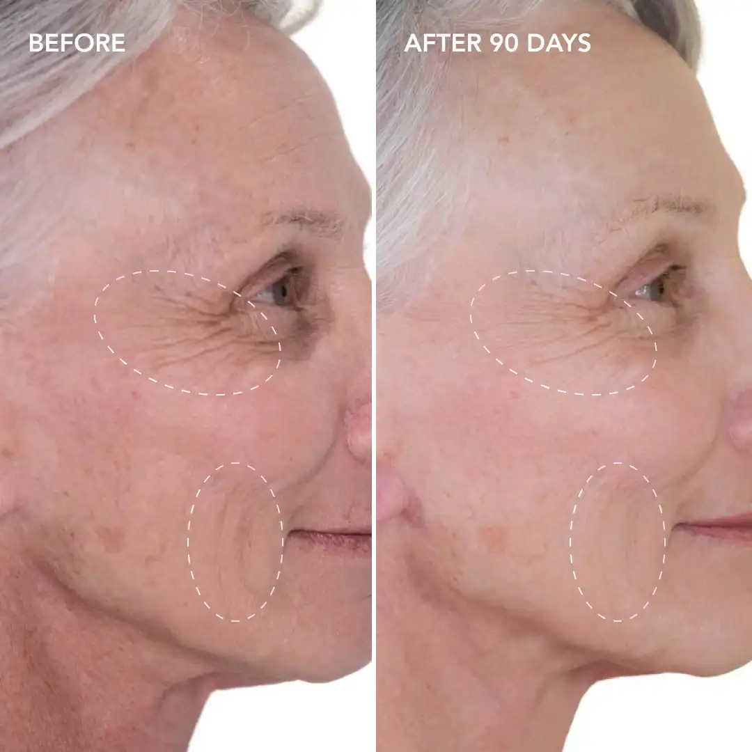 When will you see results Billericay